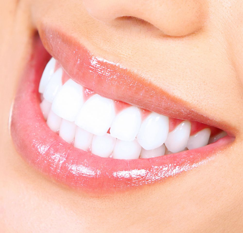 Важность профессионального отбеливания зубов